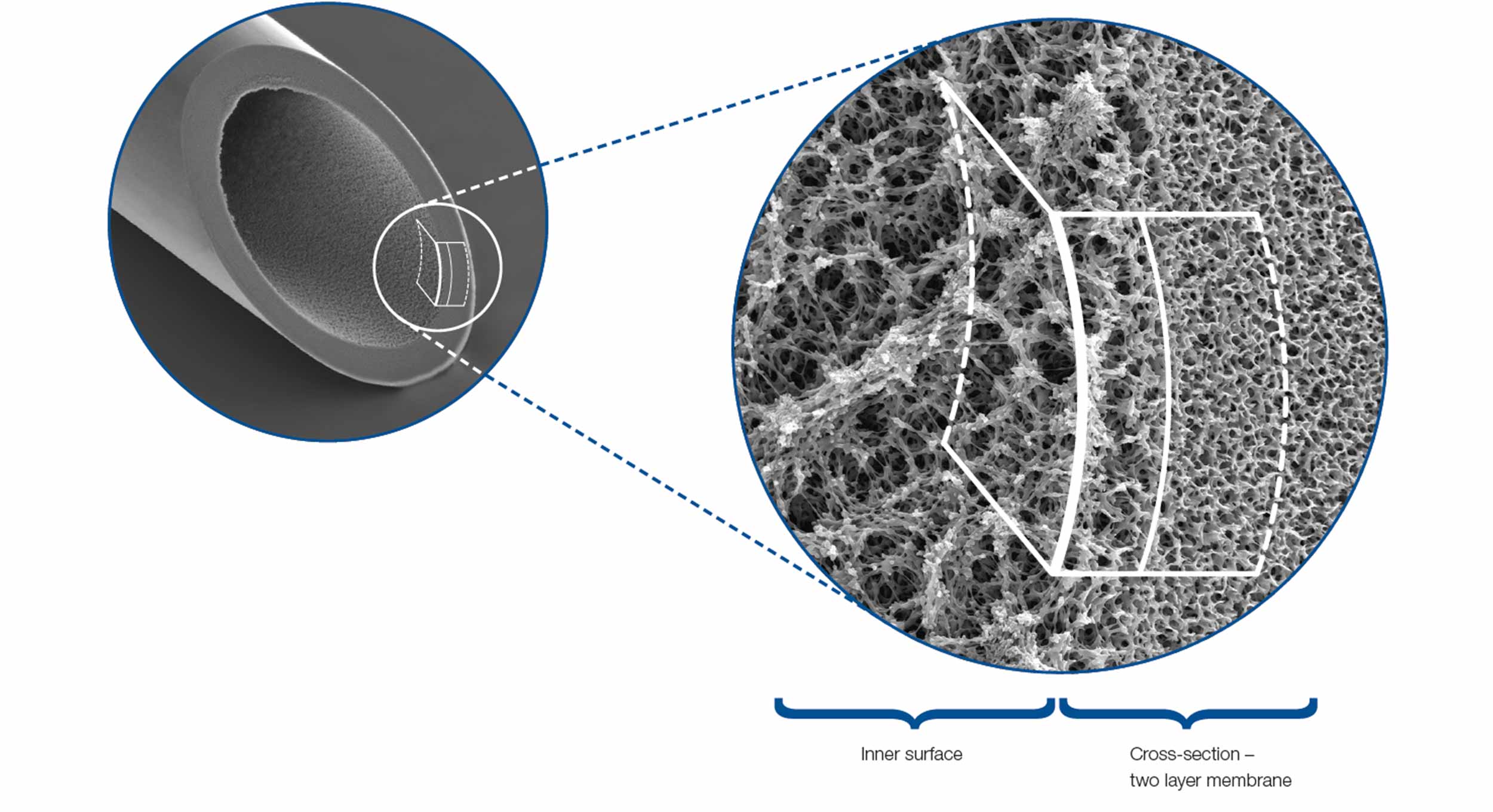 Electron micrograph of plasmafilters