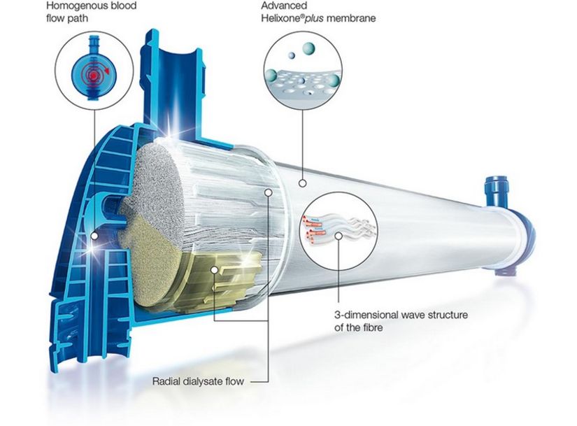 Illustration of the detailed head of FX CorDiax dialyzer